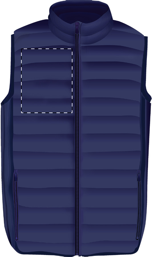 Right chest