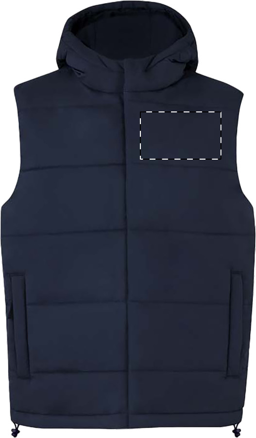 Left chest