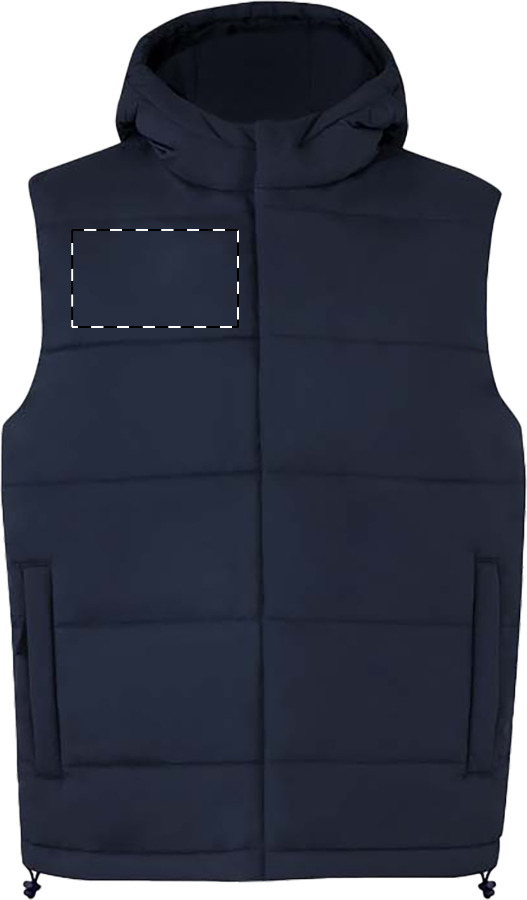 Right chest