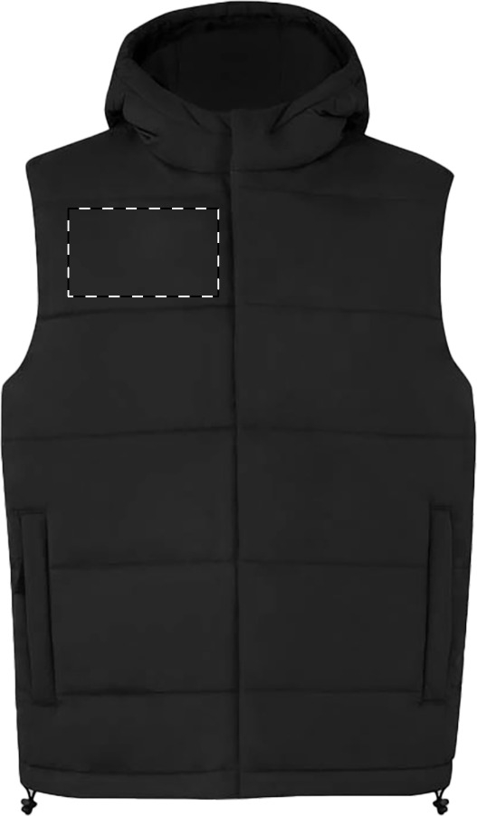 Right chest