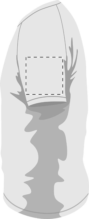 Manica sinistra